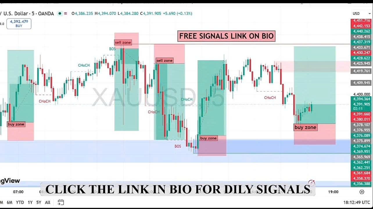 📢 Global Gold Insights 🌐