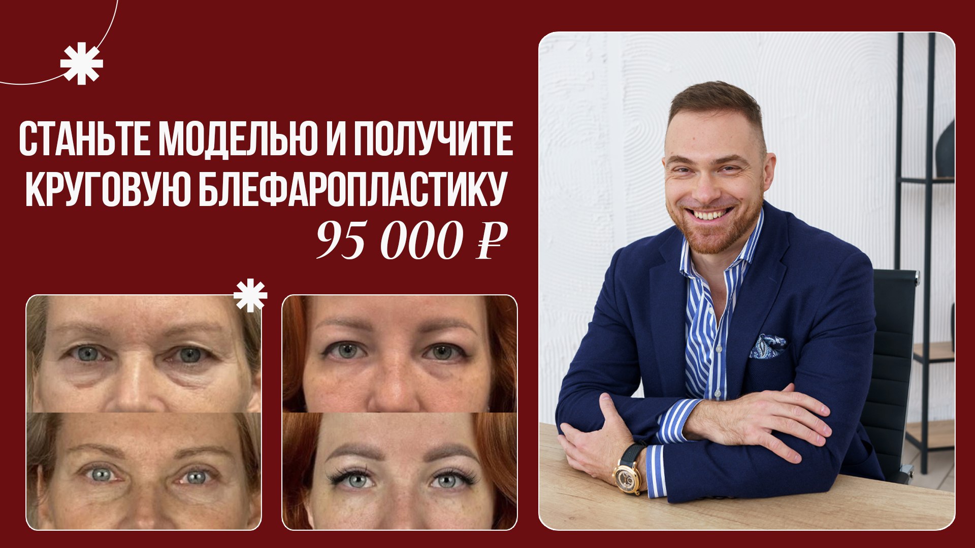 Ринопластика • Блефаропластика • Маммопластика • Беликов