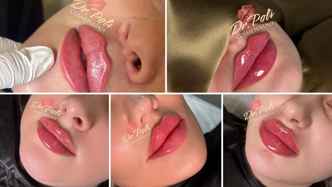 Бесплатный интенсив для косметологов💋