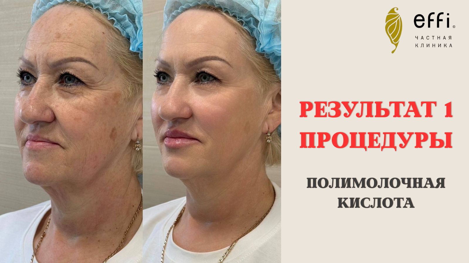 effi.clinic | клиника косметологии и хирургии