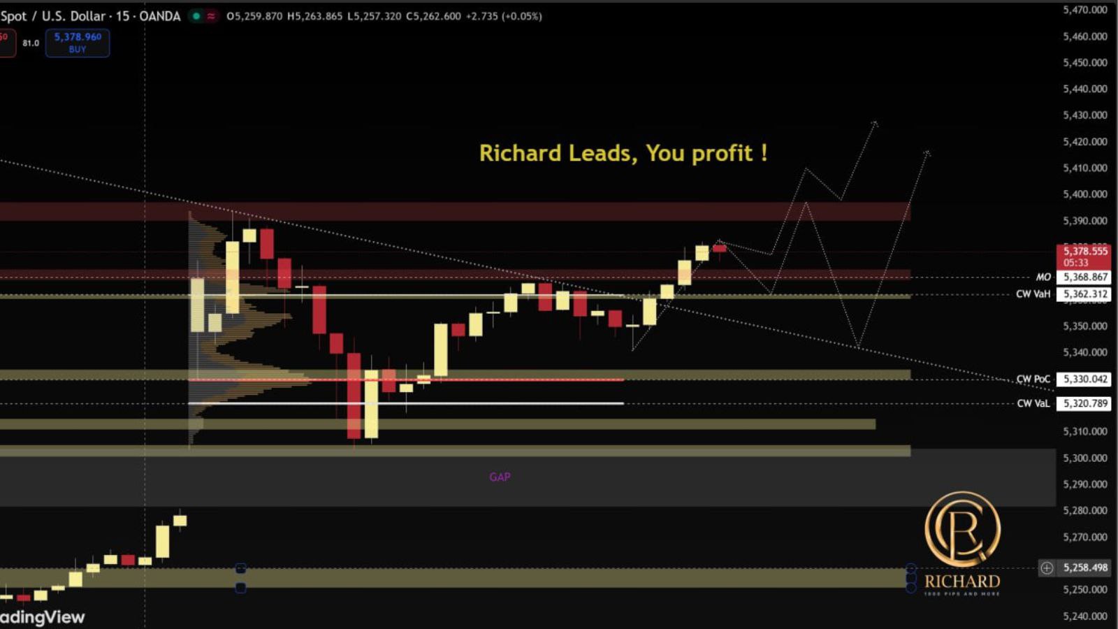 Richard 1000 Pips & More