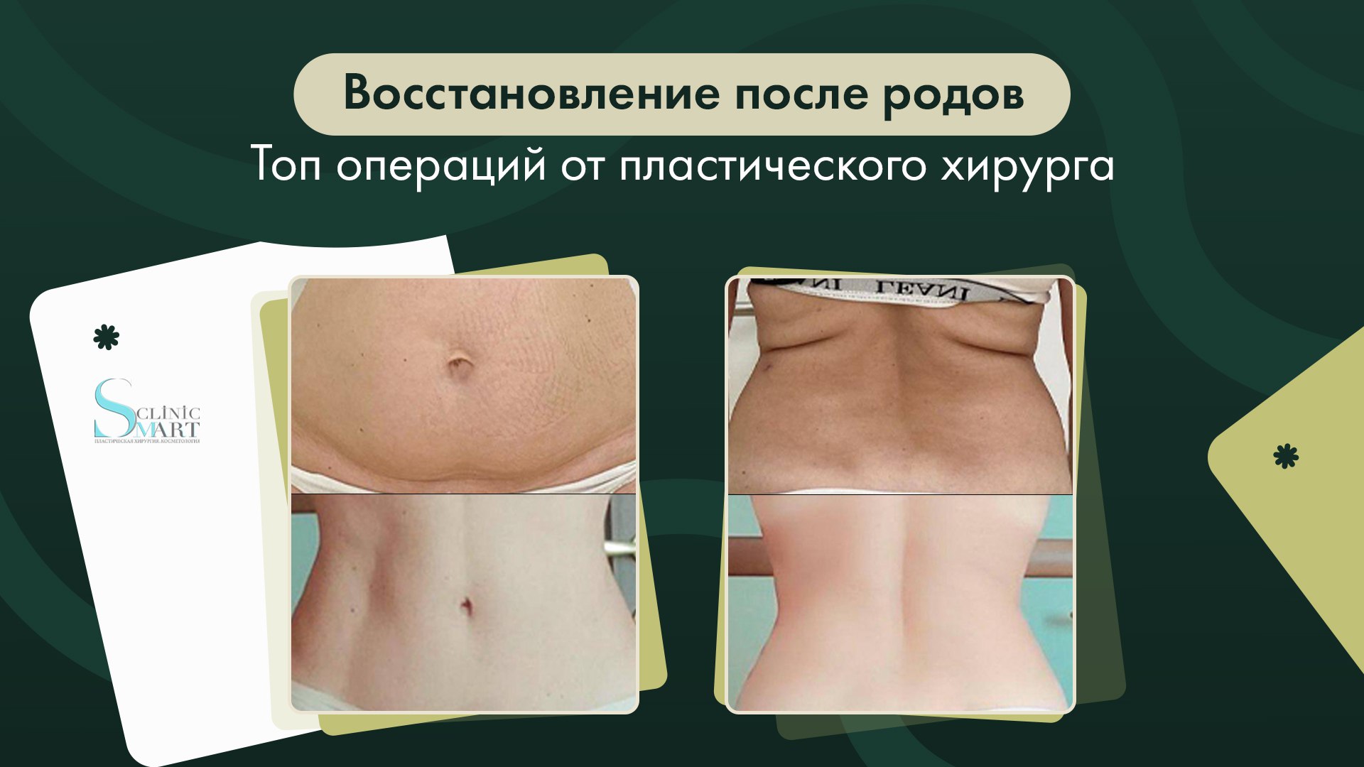 Александр Соколов. Пластическая хирургия, косметология в Smart Clinic.